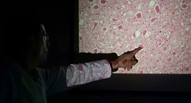 Zombi geyik hastalığı yayılıyor... 